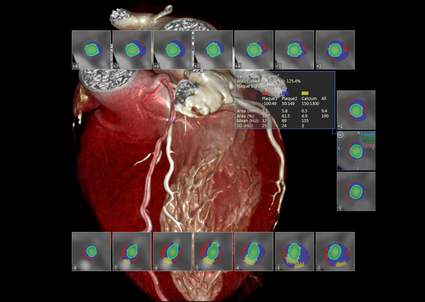 Cardiovascular - Canon Medical Informatics